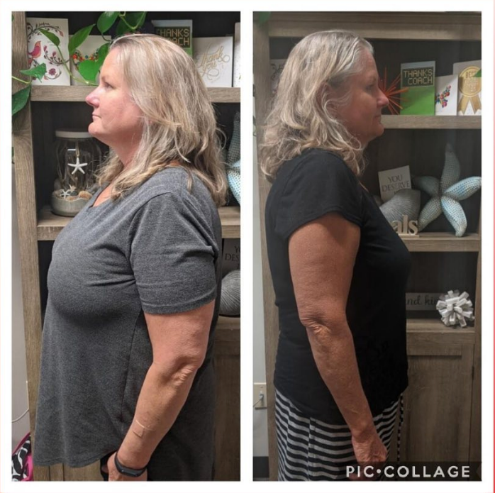 Before & After Three Points Wellness & Weight Loss